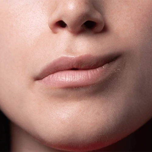 Epilepsy and Seizure Disorders